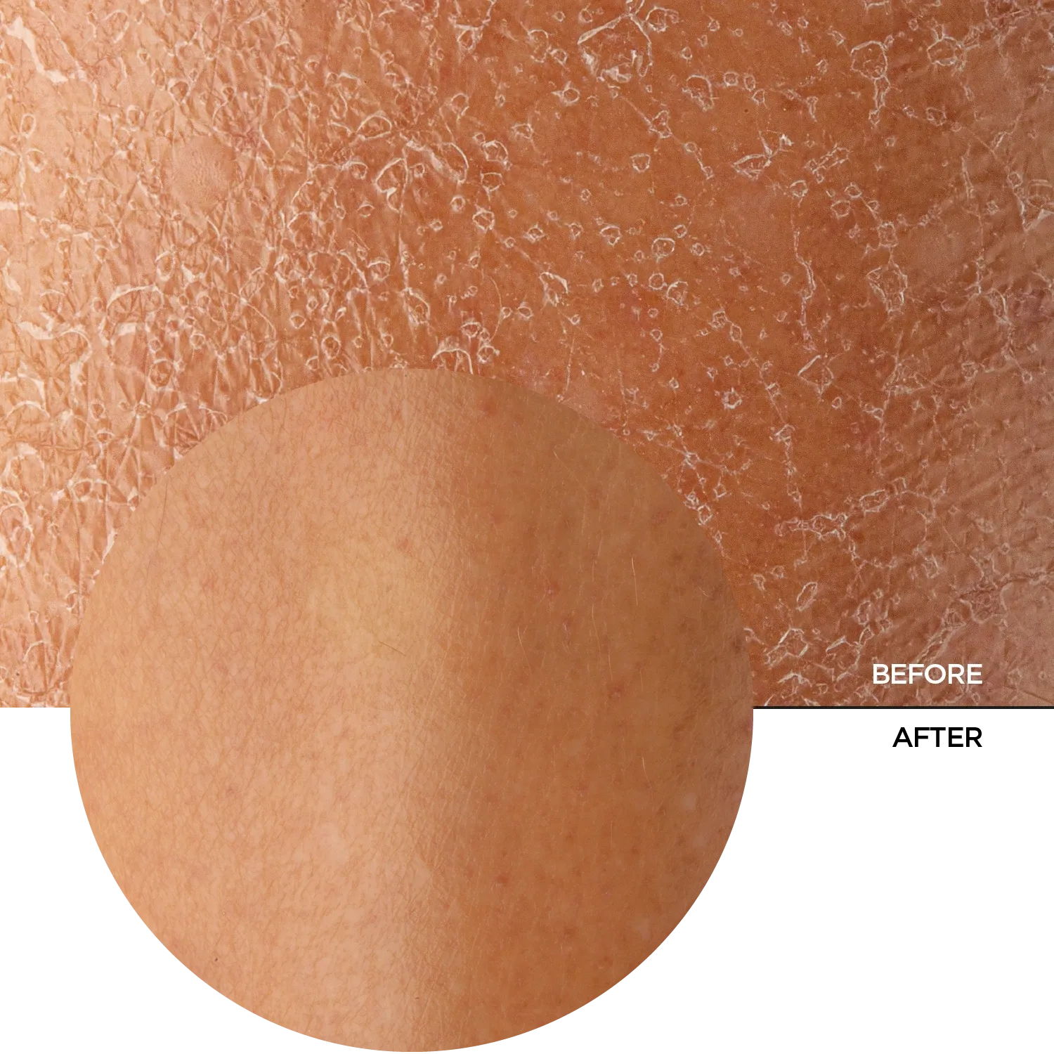 Marine Collagen   HA